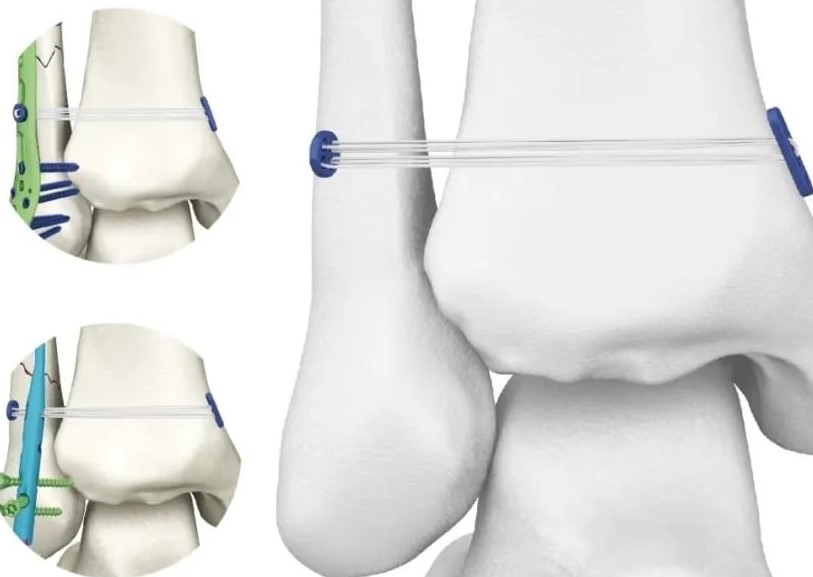 Danh mục CÁCH CHÚNG TÔI CÓ THỂ GIÚP BẠN Bạn có thể liên hệ với chúng tôi theo bất kỳ cách nào thuận tiện nhất cho bạn. Chúng tôi sẵn sàng hỗ trợ 24/7 qua email hoặc điện thoại. Liên hệ với chúng tôi Sản phẩm mới